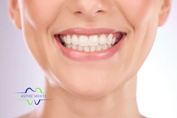 Follow your teeth whitening aftercare Kingston upon Hull to prolong your whiter smile!